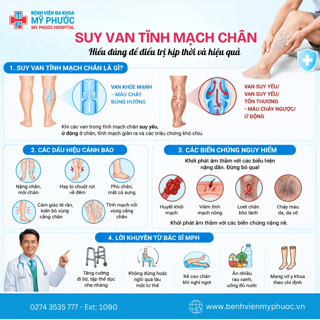 Dấu hiệu sớm của suy van tĩnh mạch chân nhiều người dễ bỏ qua