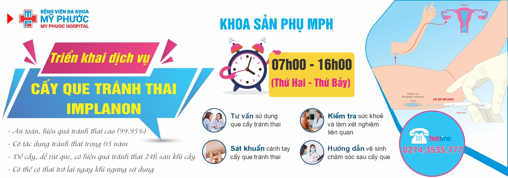 DỊCH VỤ CẤY QUE TRÁNH THAI