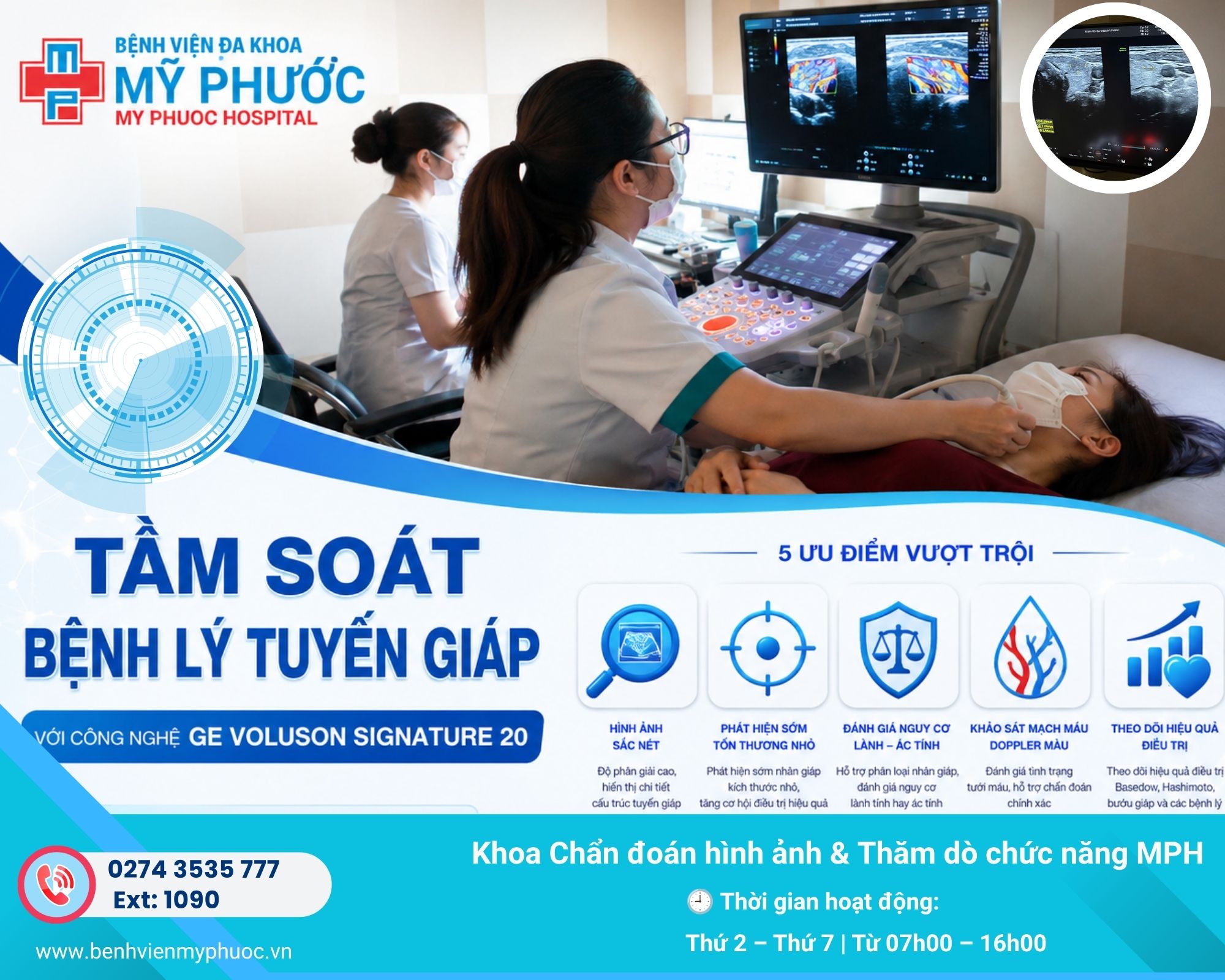 Tầm soát bệnh lý tuyến giáp với hệ thống siêu âm GE VOLUSON SIGNATURE 20