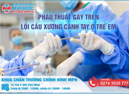 PHẪU THUẬT GÃY TRÊN LỒI CẦU XƯƠNG CÁNH TAY Ở TRẺ EM