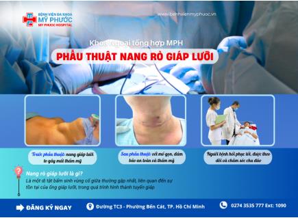 PHẪU THUẬT NANG RÒ GIÁP LƯỠI – AN TOÀN, HIỆU QUẢ, THẨM MỸ